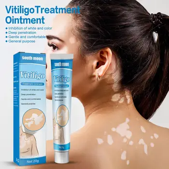 20g Tedavisi Nemlendirici Krem Beyaz Nokta Hastalığı Vitiligo Balsamı Onarım Merhem Tedavisi Rahatlatmak Cilt Kremi Vücut bakım kremi